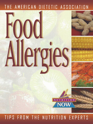 cover image of Food Allergies